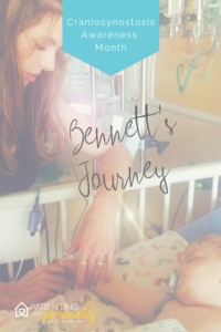 Bennett's Journey Craniosynostosis